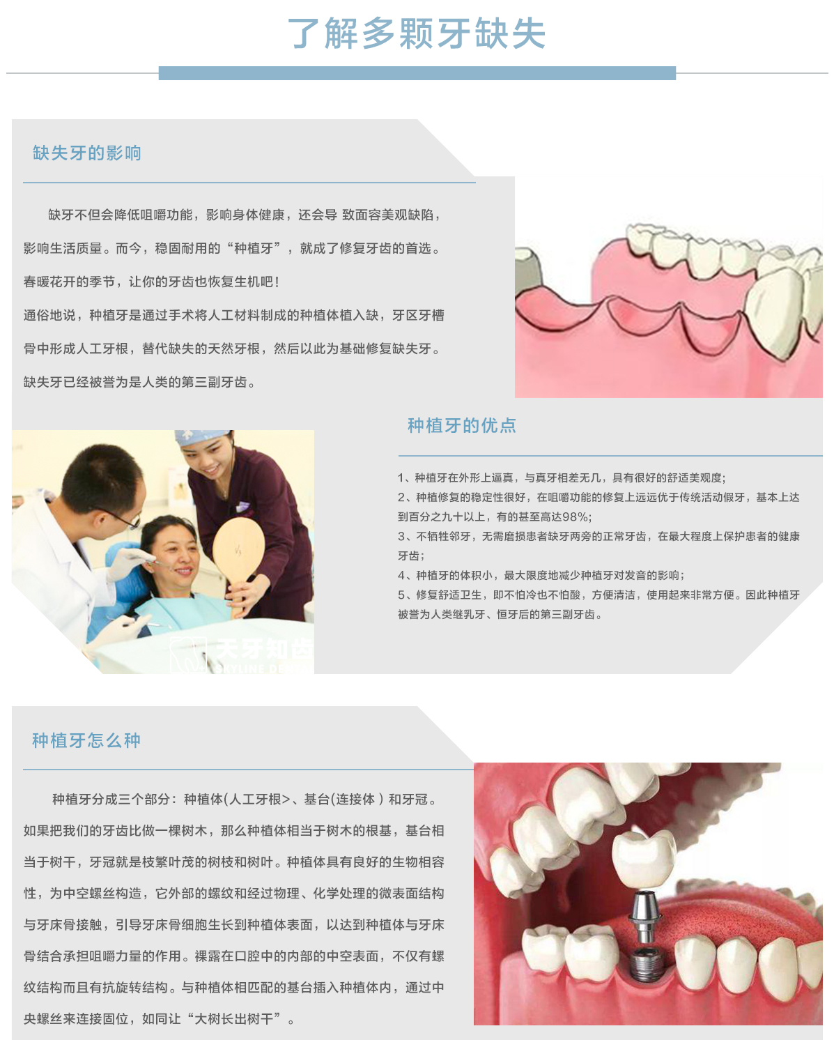 数字化种植中心多颗牙缺失.jpg