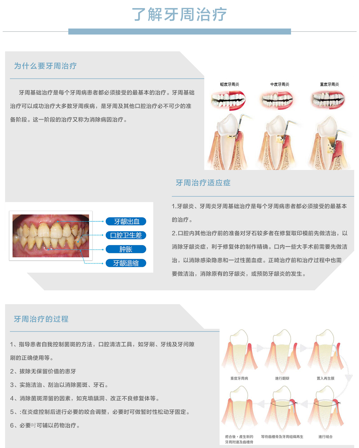 常规治疗牙周治疗.jpg