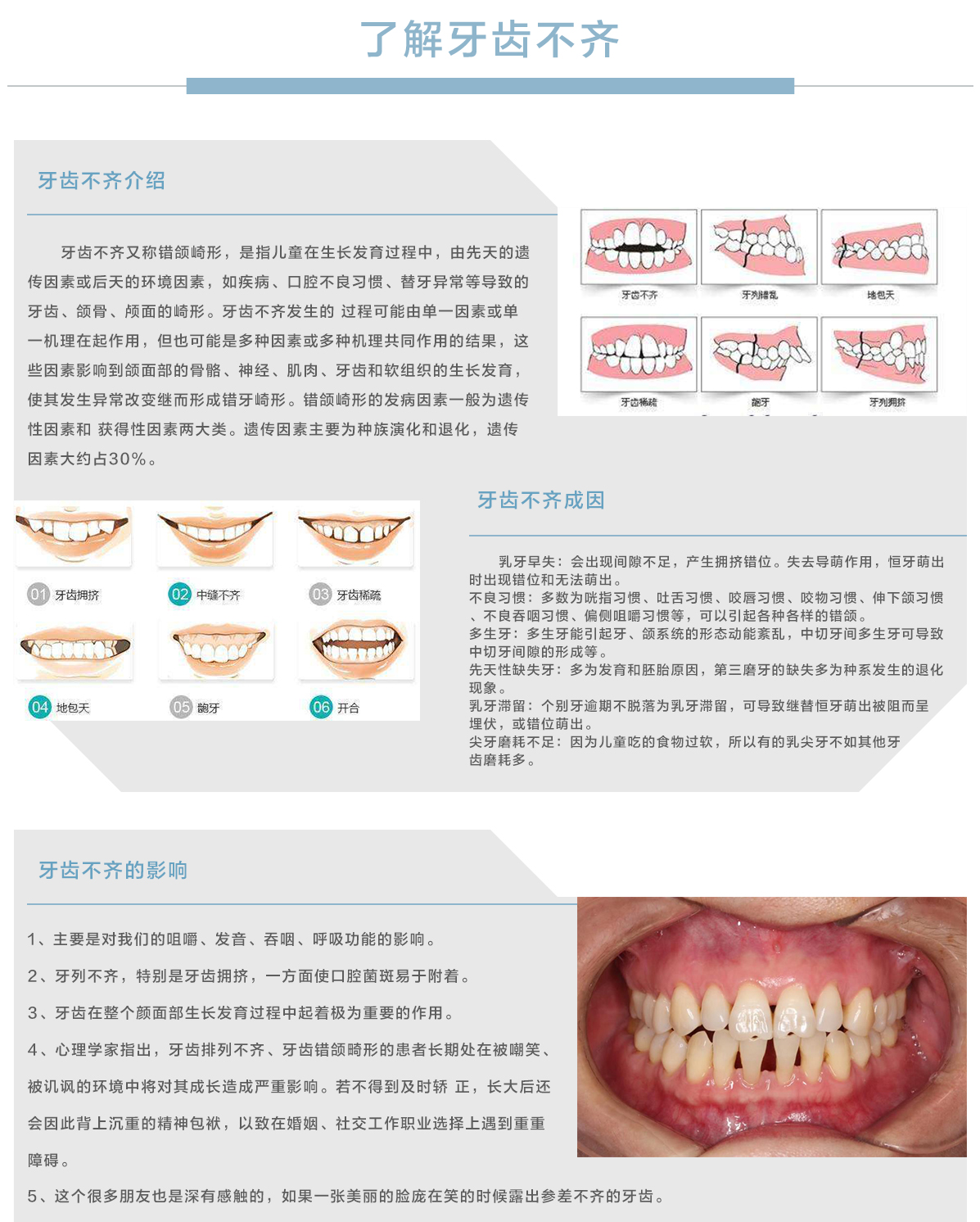 数字化正畸中心牙齿不齐.jpg