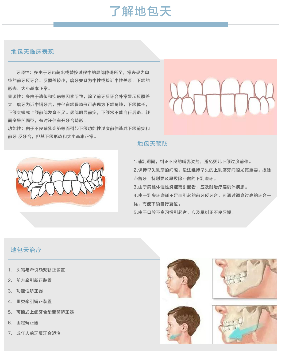 数字化正畸中心地包天.jpg