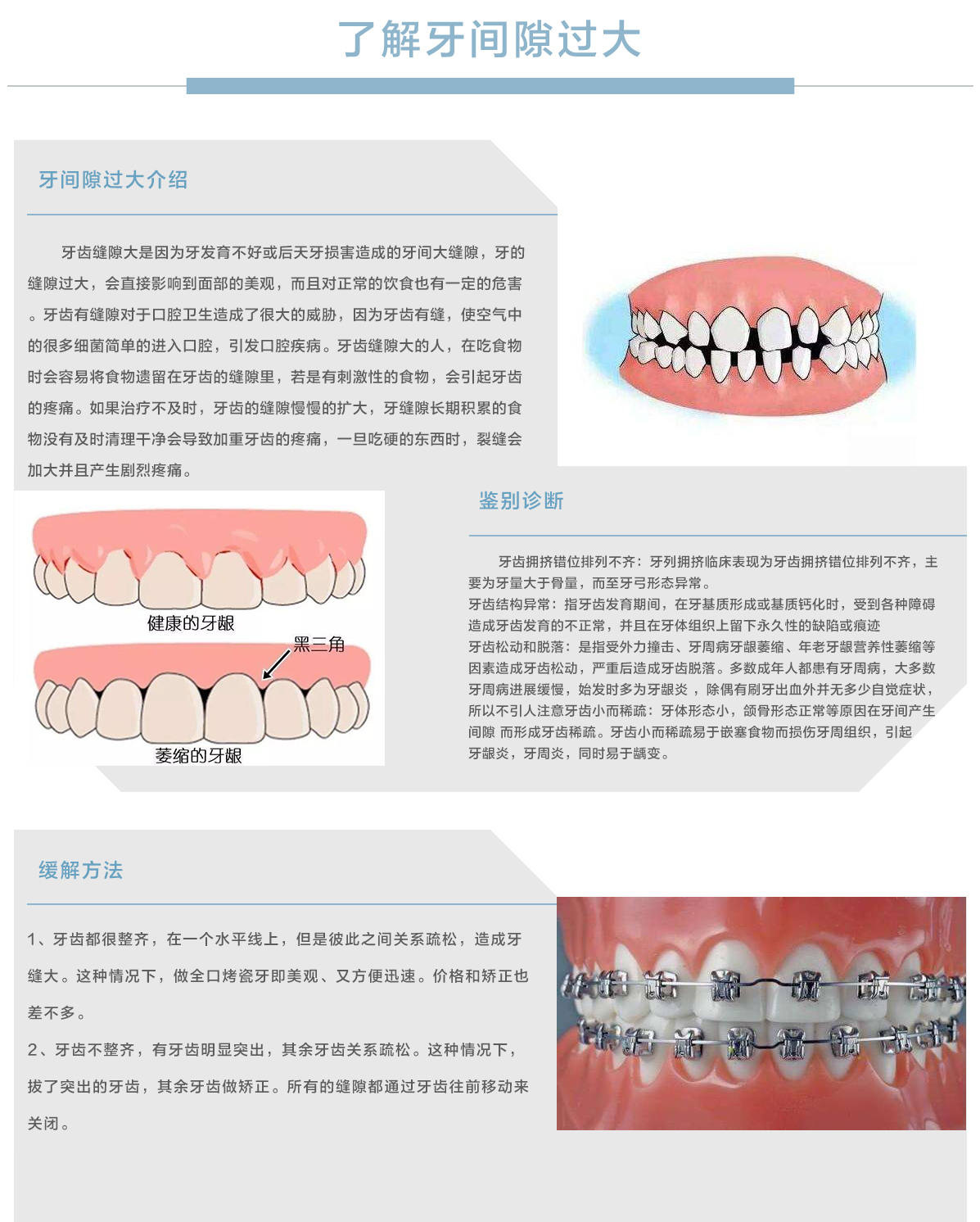 数字化正畸中心牙间隙过大.jpg