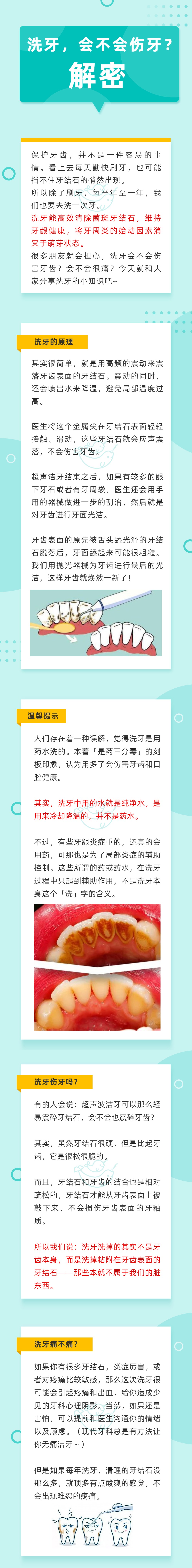 洗牙会不会伤牙？.jpg