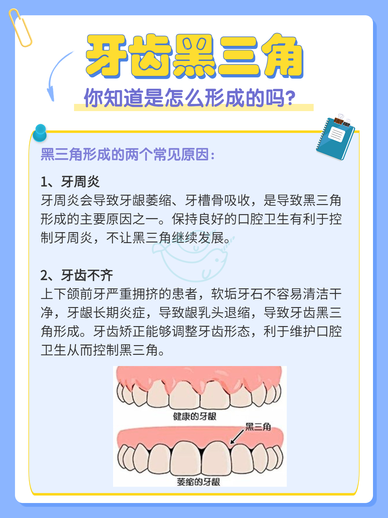 牙齿黑三角.jpg